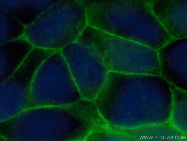 ATP1A1 Antibody in Immunocytochemistry (ICC/IF)