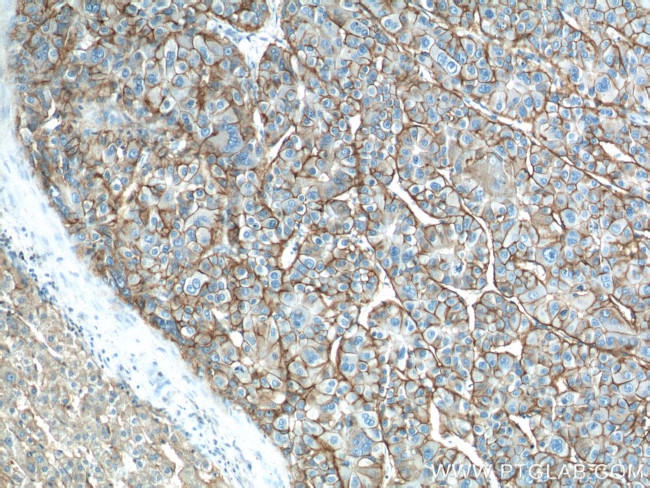 ATP1A1 Antibody in Immunohistochemistry (Paraffin) (IHC (P))