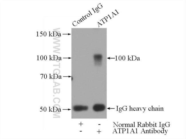 ATP1A1 Antibody in Immunoprecipitation (IP)