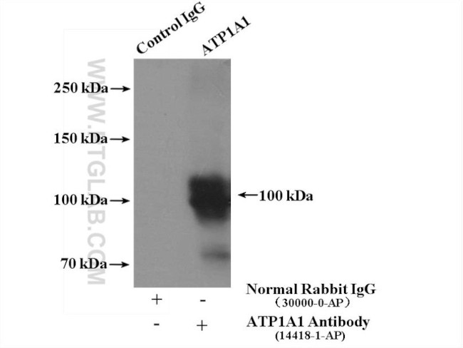 ATP1A1 Antibody in Immunoprecipitation (IP)