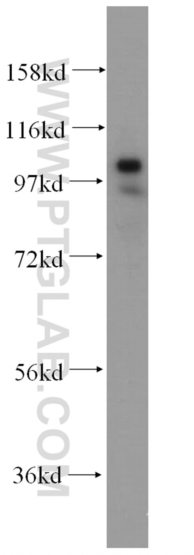 ATP1A1 Antibody in Western Blot (WB)