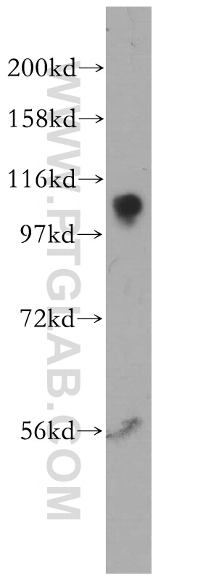 ATP1A1 Antibody in Western Blot (WB)