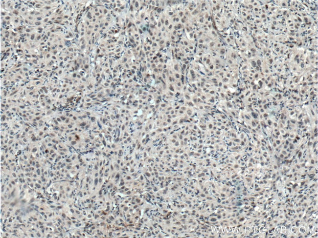 TCF12/HEB Antibody in Immunohistochemistry (Paraffin) (IHC (P))