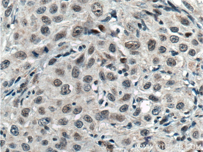 TCF12/HEB Antibody in Immunohistochemistry (Paraffin) (IHC (P))