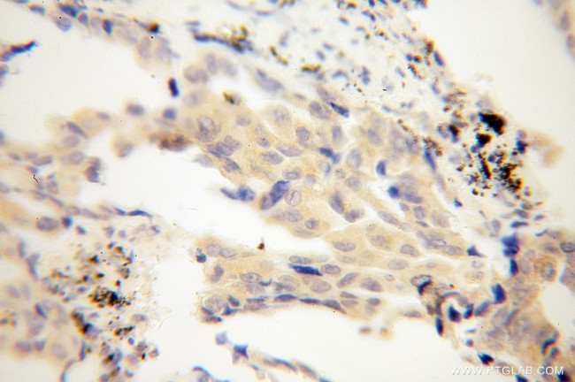 CHSY1 Antibody in Immunohistochemistry (Paraffin) (IHC (P))