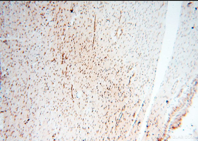 TIMELESS Antibody in Immunohistochemistry (Paraffin) (IHC (P))