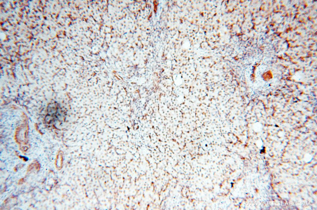 TIMELESS Antibody in Immunohistochemistry (Paraffin) (IHC (P))