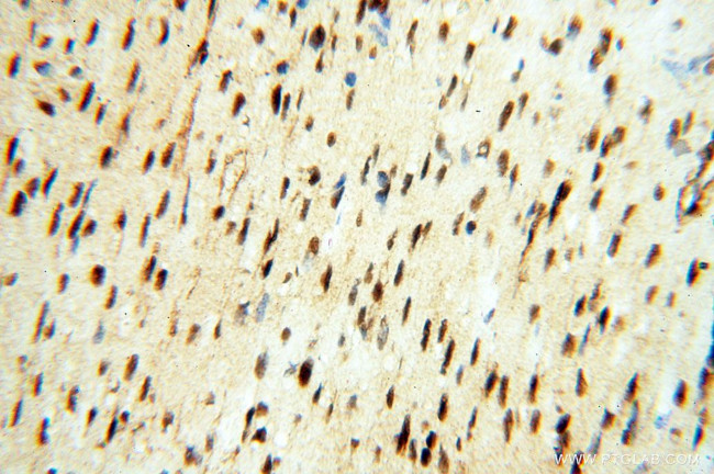 TIMELESS Antibody in Immunohistochemistry (Paraffin) (IHC (P))