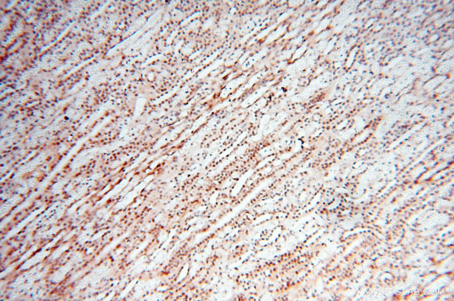 TIMELESS Antibody in Immunohistochemistry (Paraffin) (IHC (P))