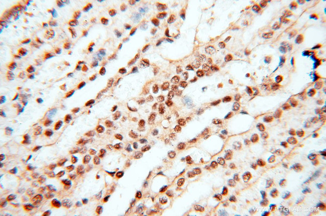 TIMELESS Antibody in Immunohistochemistry (Paraffin) (IHC (P))