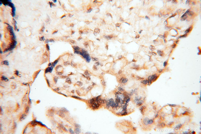 TIMELESS Antibody in Immunohistochemistry (Paraffin) (IHC (P))