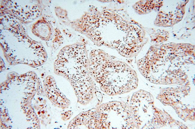 TIMELESS Antibody in Immunohistochemistry (Paraffin) (IHC (P))