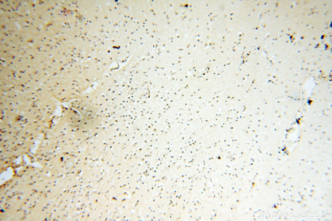 TIMELESS Antibody in Immunohistochemistry (Paraffin) (IHC (P))