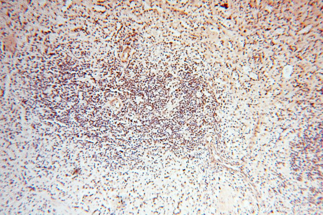 TIMELESS Antibody in Immunohistochemistry (Paraffin) (IHC (P))