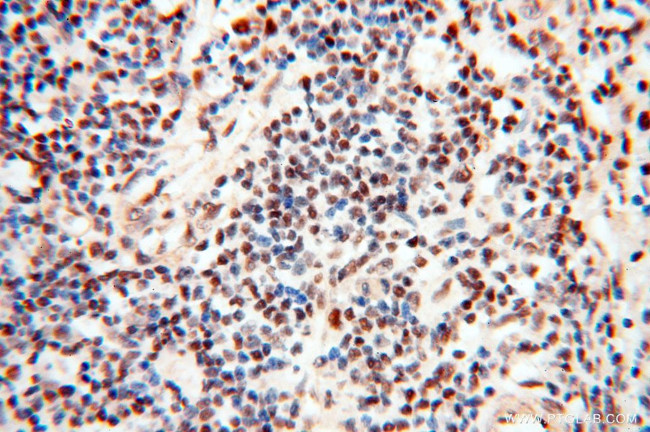 TIMELESS Antibody in Immunohistochemistry (Paraffin) (IHC (P))