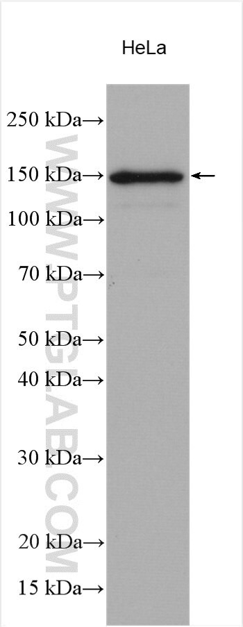 TIMELESS Antibody in Western Blot (WB)