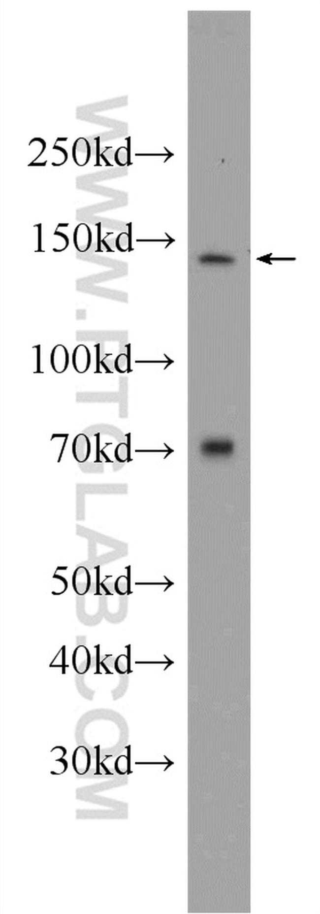 TIMELESS Antibody in Western Blot (WB)