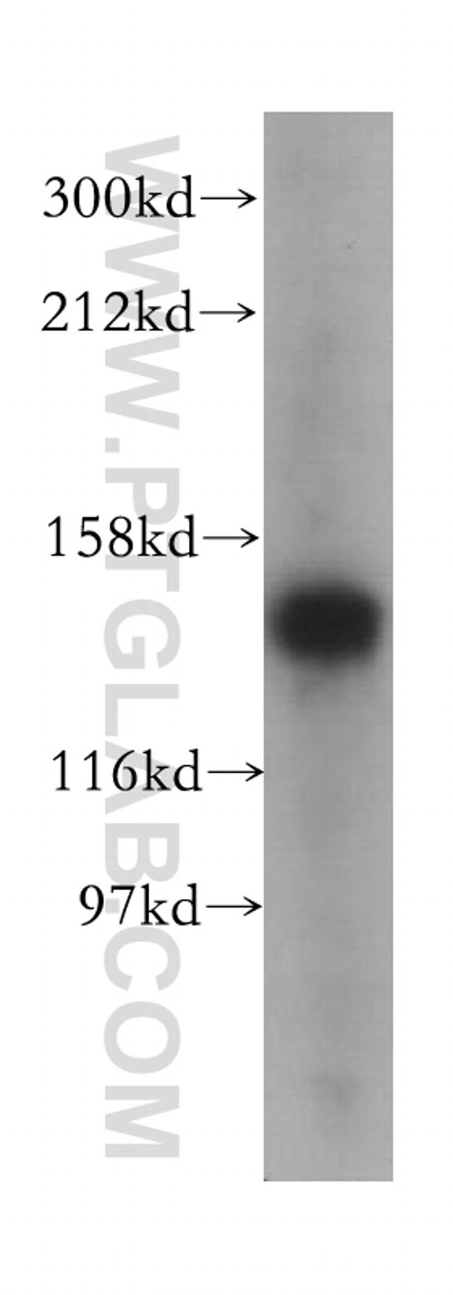 TIMELESS Antibody in Western Blot (WB)