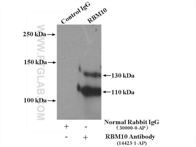 RBM10 Antibody in Immunoprecipitation (IP)