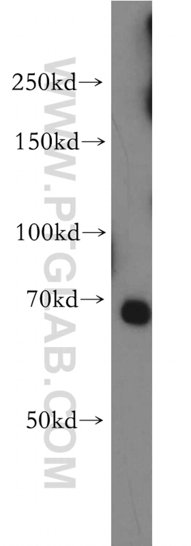 TAX1BP1 Antibody in Western Blot (WB)