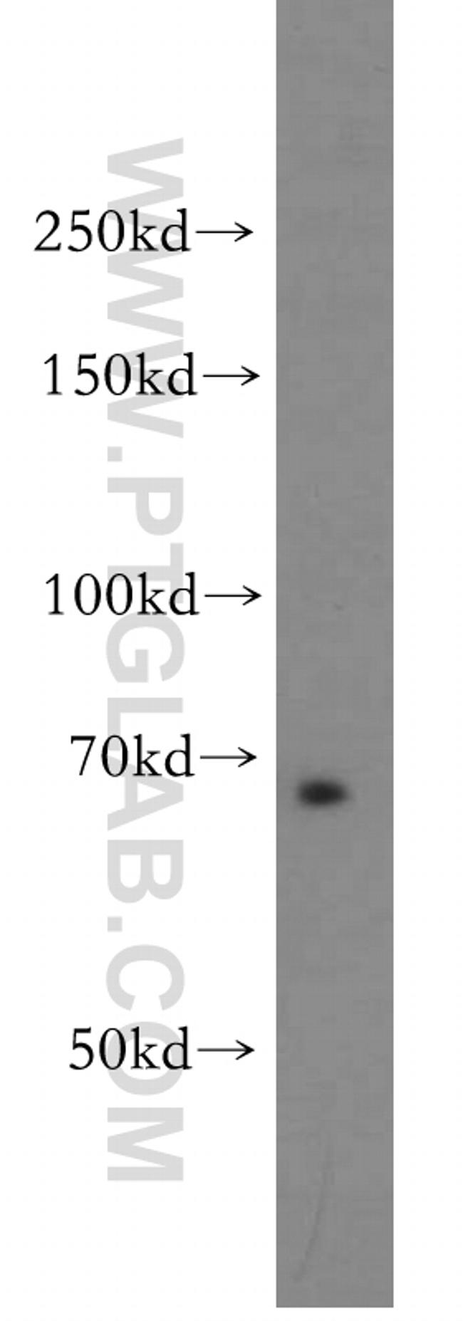 TAX1BP1 Antibody in Western Blot (WB)