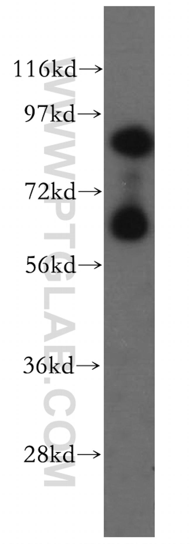 TAX1BP1 Antibody in Western Blot (WB)