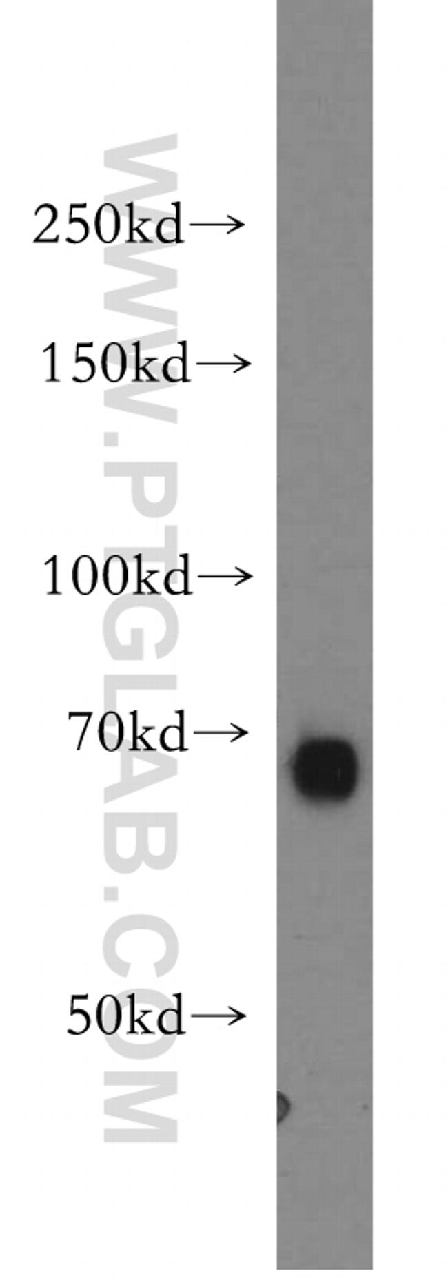 TAX1BP1 Antibody in Western Blot (WB)