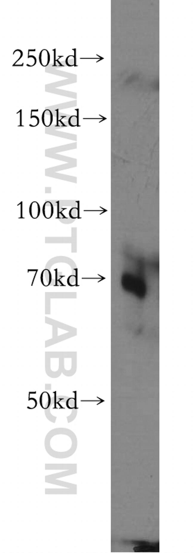 TAX1BP1 Antibody in Western Blot (WB)