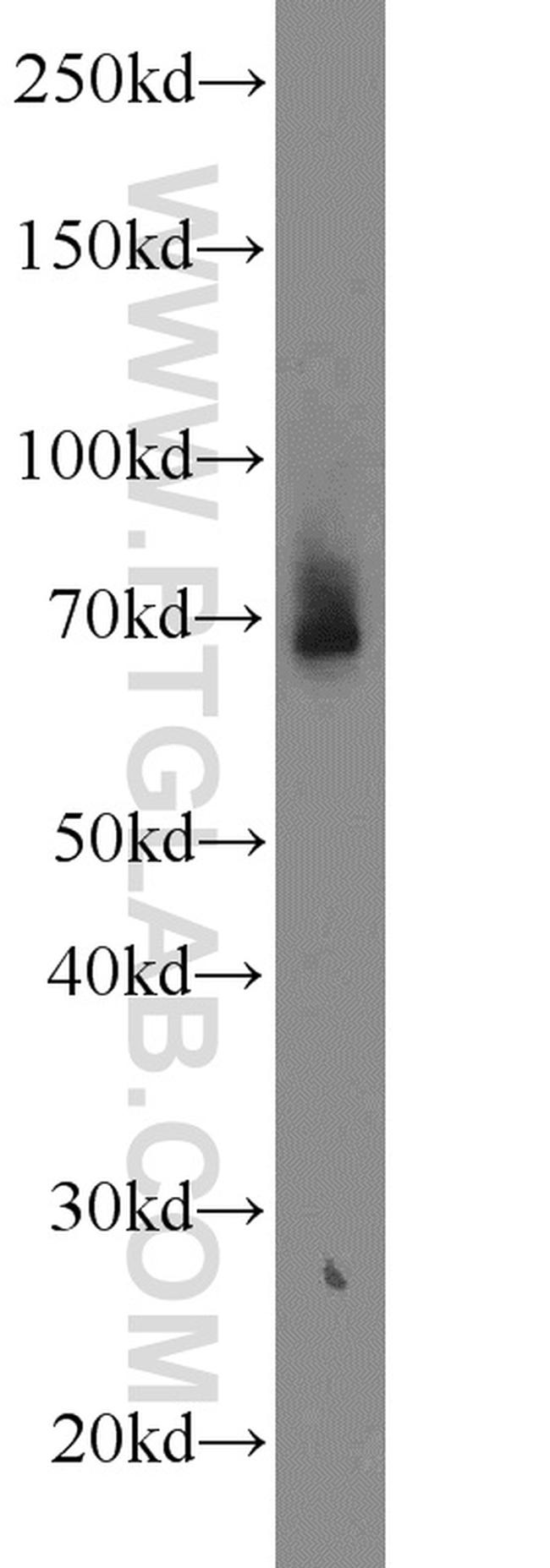 TAX1BP1 Antibody in Western Blot (WB)