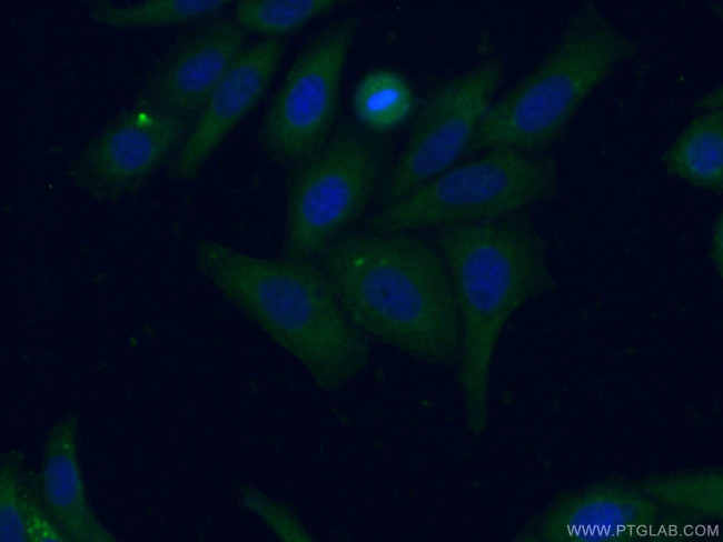 Apolipoprotein AI Antibody in Immunocytochemistry (ICC/IF)