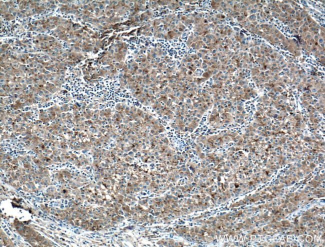 Apolipoprotein AI Antibody in Immunohistochemistry (Paraffin) (IHC (P))