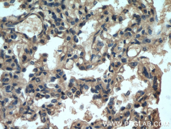 Apolipoprotein AI Antibody in Immunohistochemistry (Paraffin) (IHC (P))