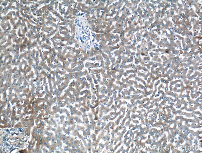 Apolipoprotein AI Antibody in Immunohistochemistry (Paraffin) (IHC (P))