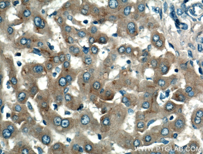 Apolipoprotein AI Antibody in Immunohistochemistry (Paraffin) (IHC (P))