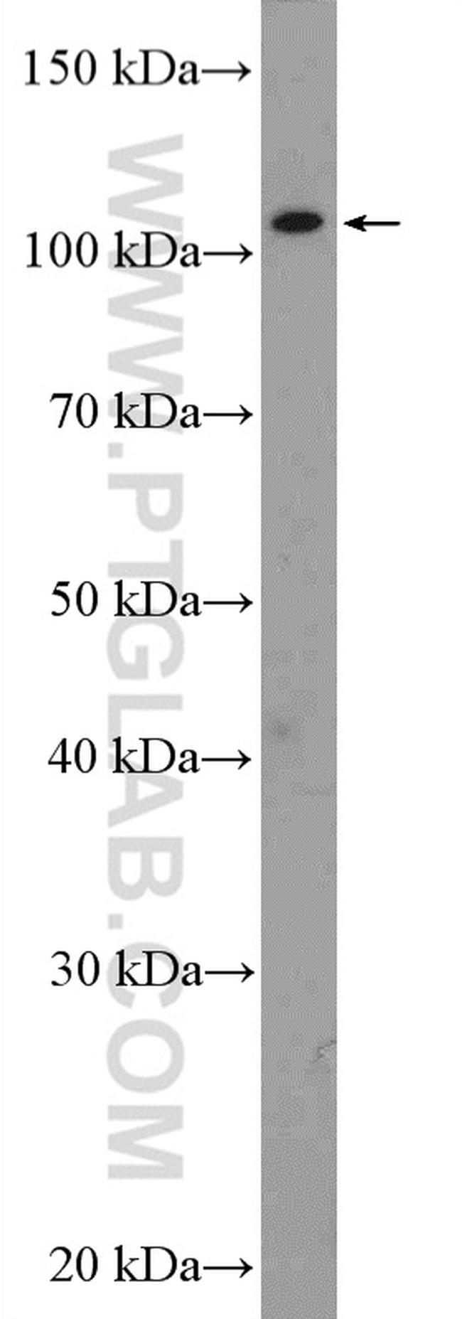 SETDB2 Antibody in Western Blot (WB)