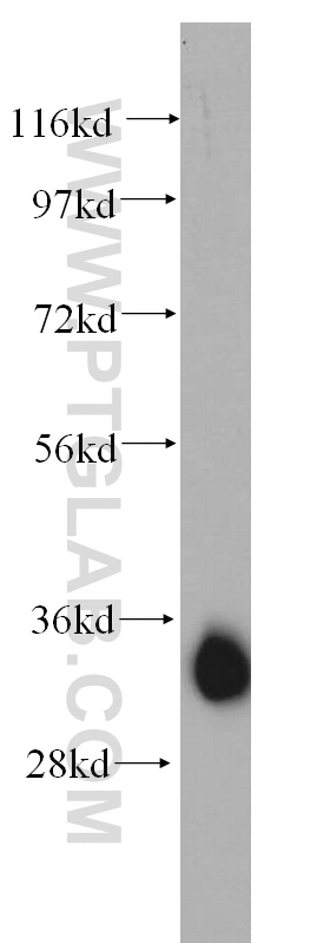 AMPK beta 2 Antibody in Western Blot (WB)