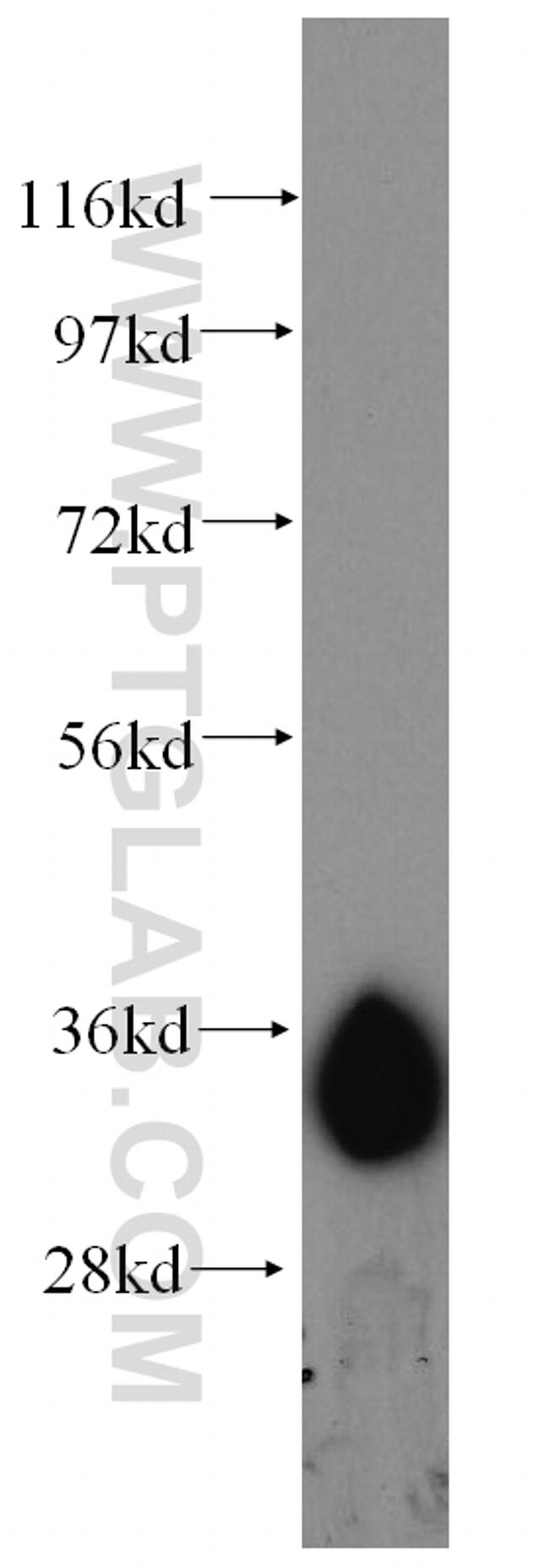 AMPK beta 2 Antibody in Western Blot (WB)