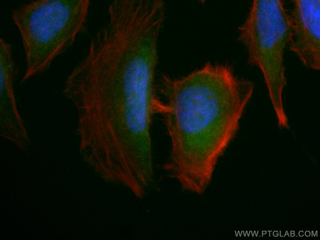 AMPK beta 2 Antibody in Immunocytochemistry (ICC/IF)