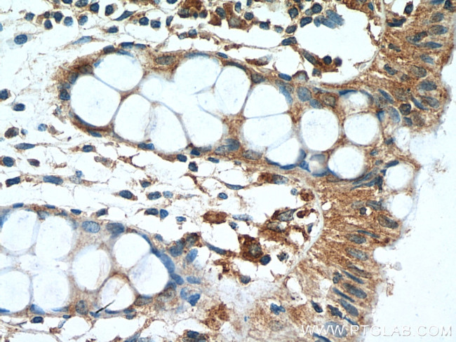 AMPK beta 2 Antibody in Immunohistochemistry (Paraffin) (IHC (P))