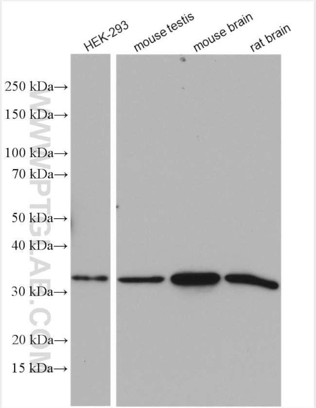 AMPK beta 2 Antibody in Western Blot (WB)