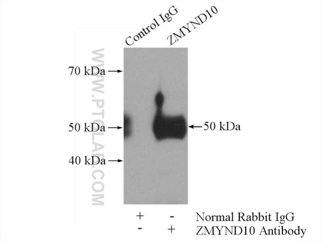 ZMYND10 Antibody in Immunoprecipitation (IP)