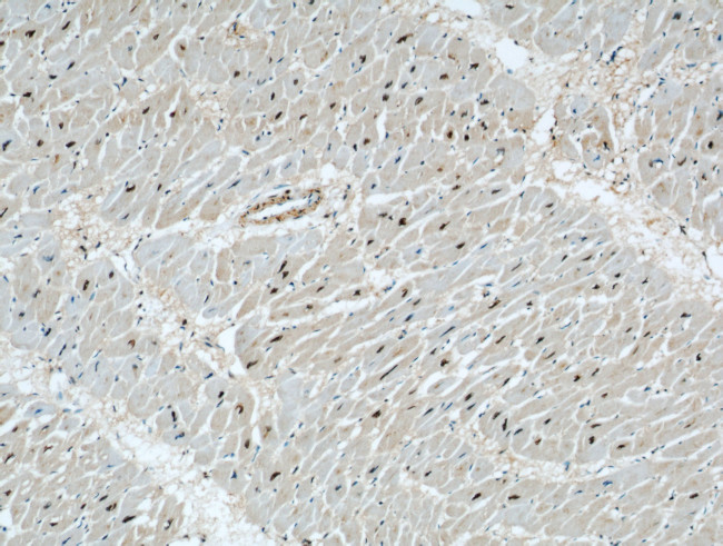 STK17A Antibody in Immunohistochemistry (Paraffin) (IHC (P))