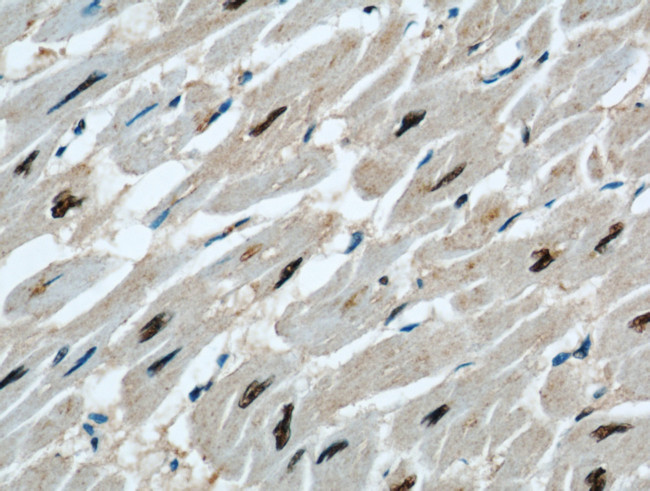 STK17A Antibody in Immunohistochemistry (Paraffin) (IHC (P))