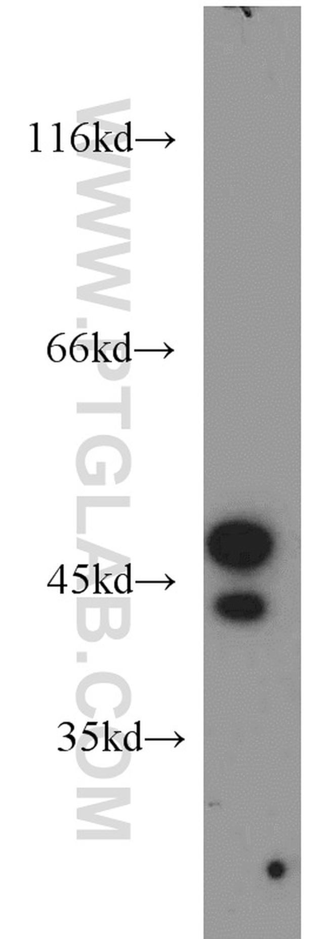 STK17A Antibody in Western Blot (WB)