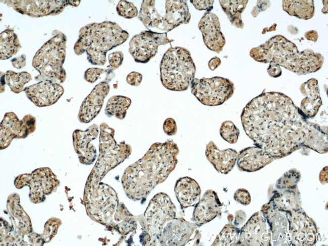 STK17A Antibody in Immunohistochemistry (Paraffin) (IHC (P))