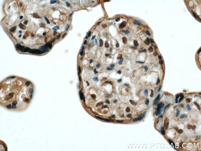 STK17A Antibody in Immunohistochemistry (Paraffin) (IHC (P))