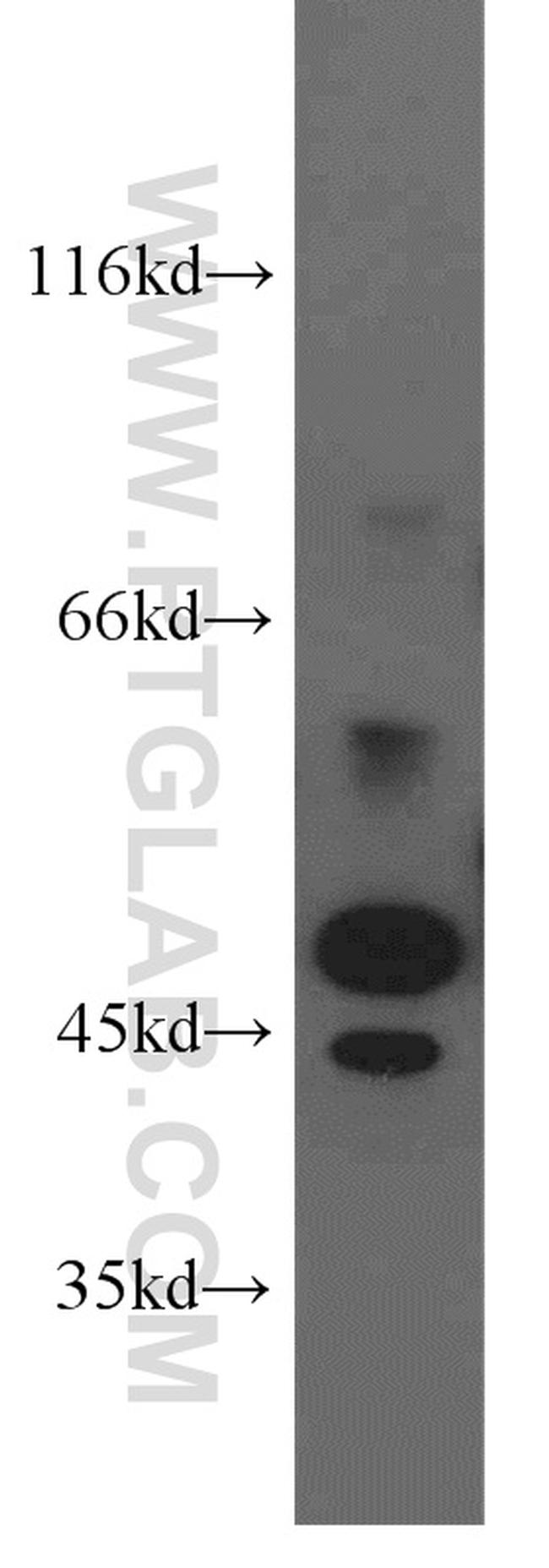 STK17A Antibody in Western Blot (WB)