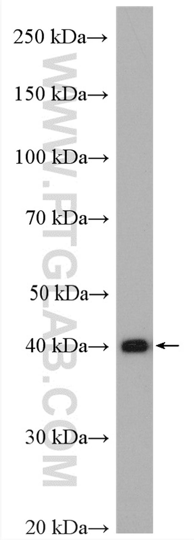 PPME1 Antibody in Western Blot (WB)