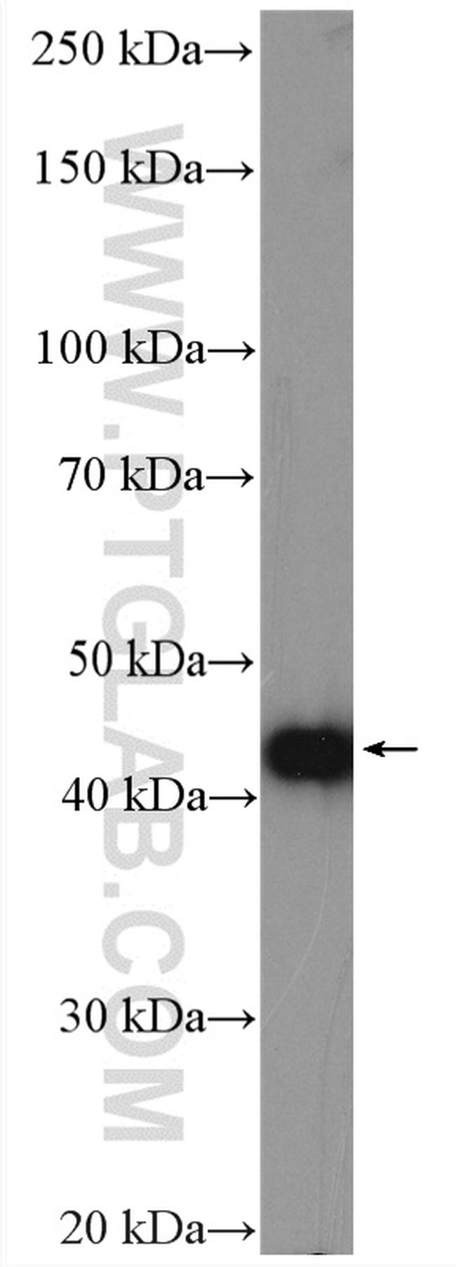 PPME1 Antibody in Western Blot (WB)