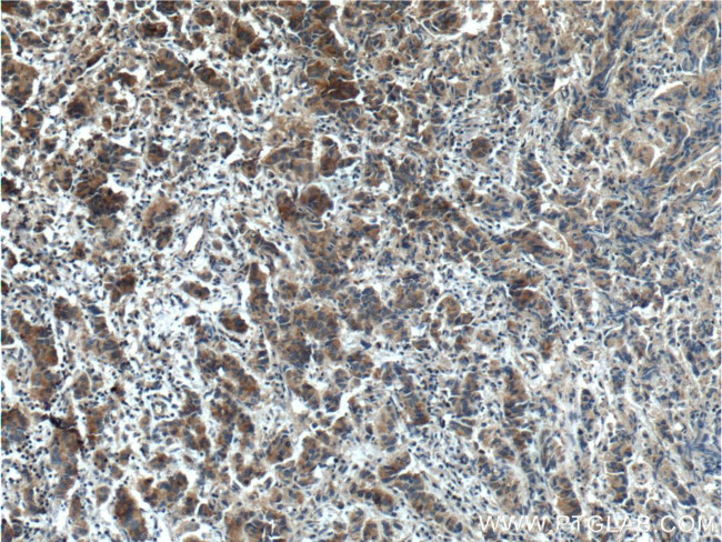 TMPRSS2 Antibody in Immunohistochemistry (Paraffin) (IHC (P))